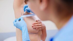 How Long Before Pregnancy (see main article)