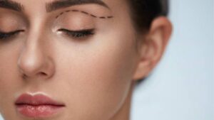How Much Does Ptosis (Droopy Eyelid) Surgery Cost?