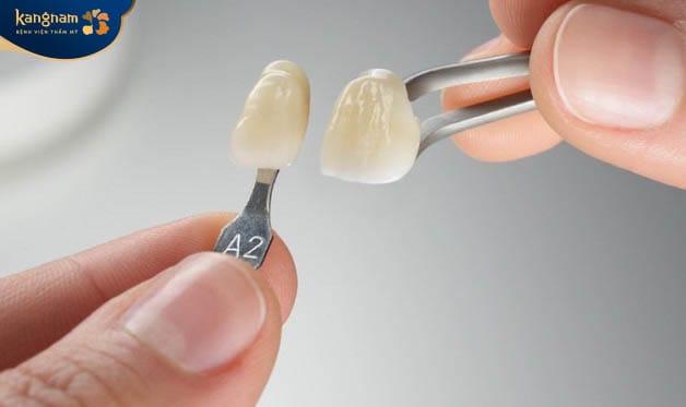 Những trường hợp nên trồng răng sứ Lava