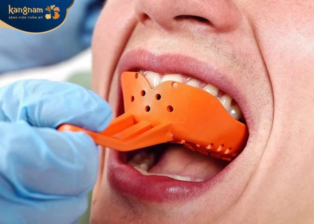 Lấy dấu răng để thiết kế răng Lava phù hợp