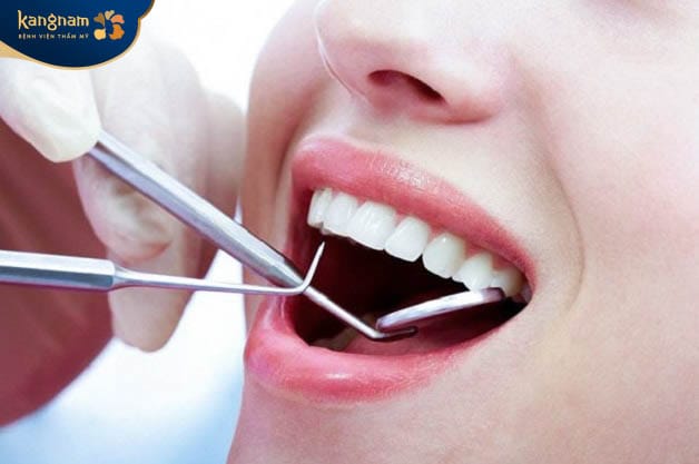 Tái khám kiểm tra răng định kỳ