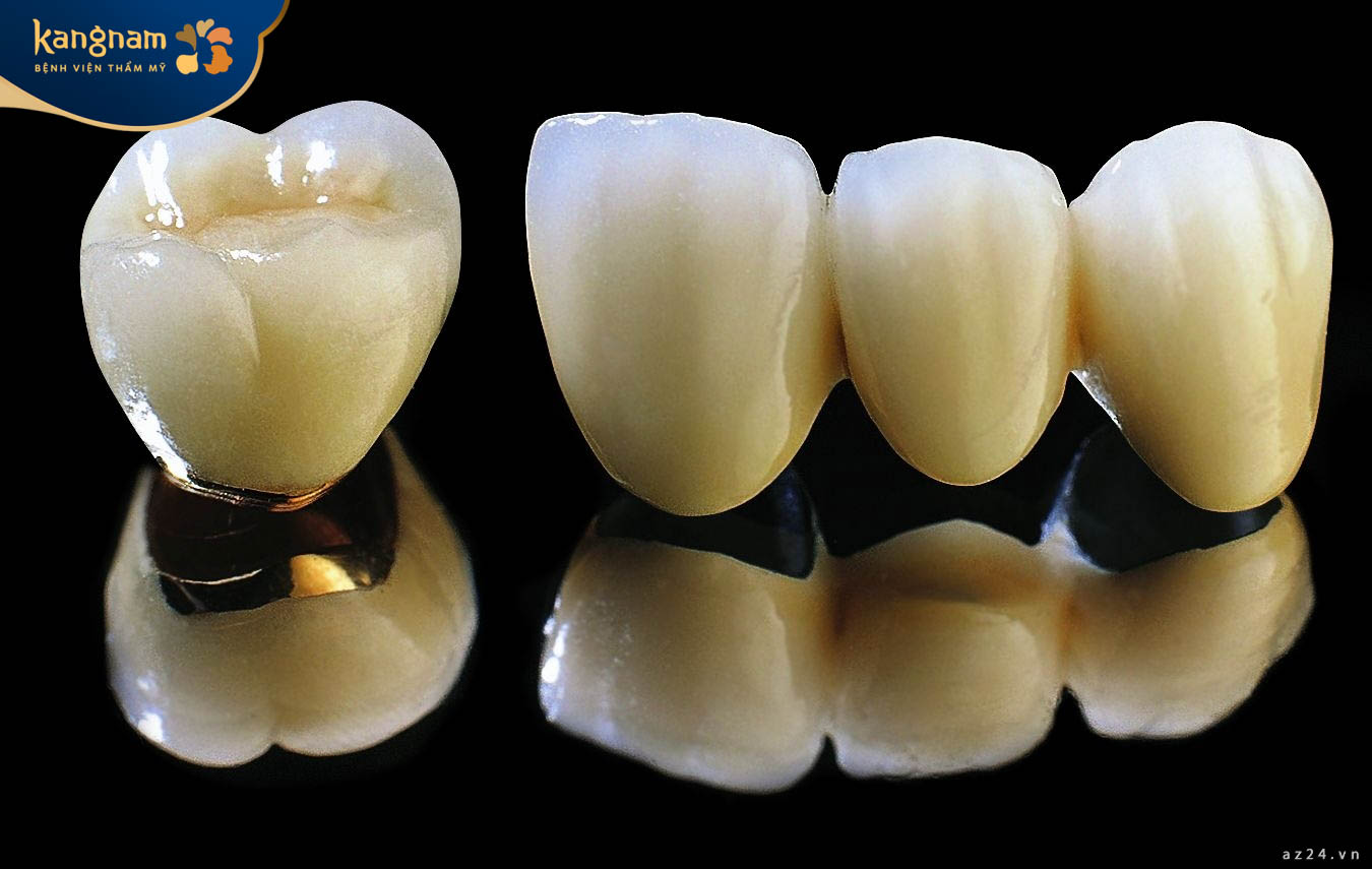 Mão sứ Titan không mang tính thẩm mỹ cao