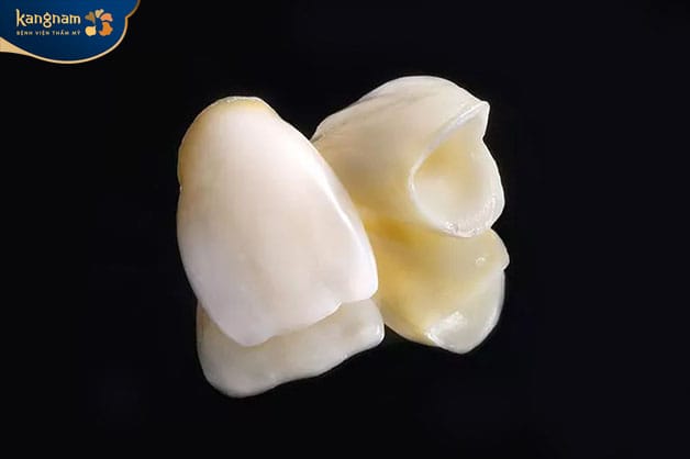 Venus Porcelain Crowns: Natural Aesthetics