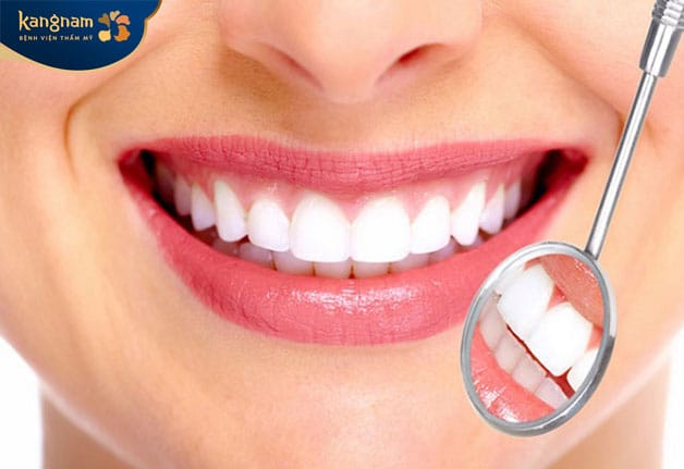 Sau khi làm răng duy trì được khoảng 15 năm 