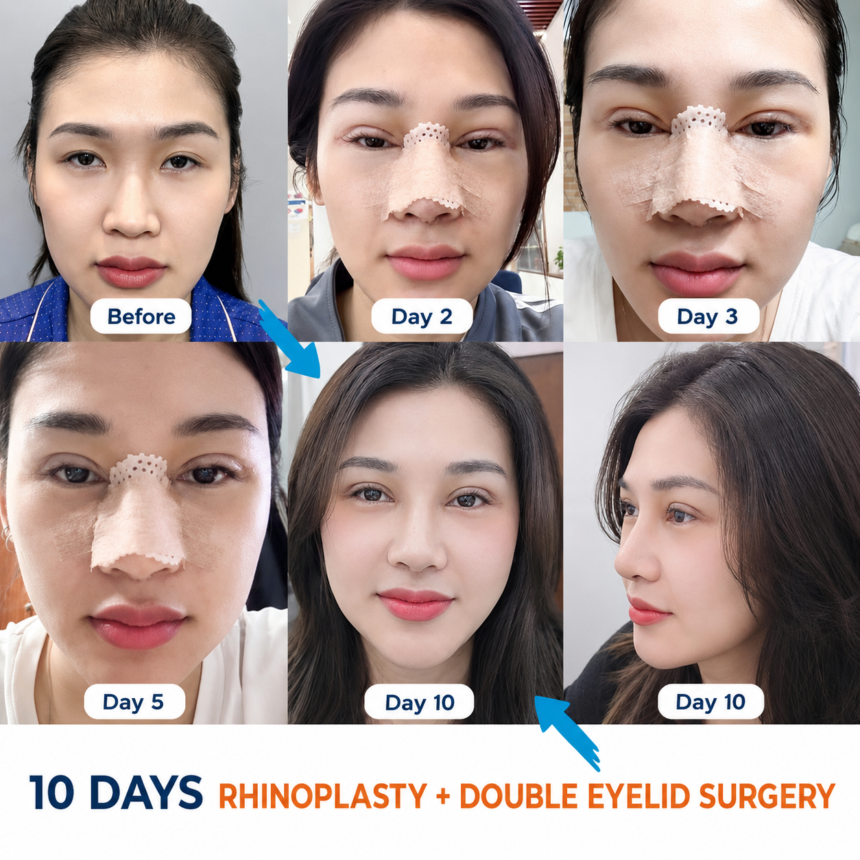 Recovery time following cosmetic surgery occurs relatively fast