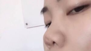 Removing a Nose Implant: Will the Nose Return to Normal?