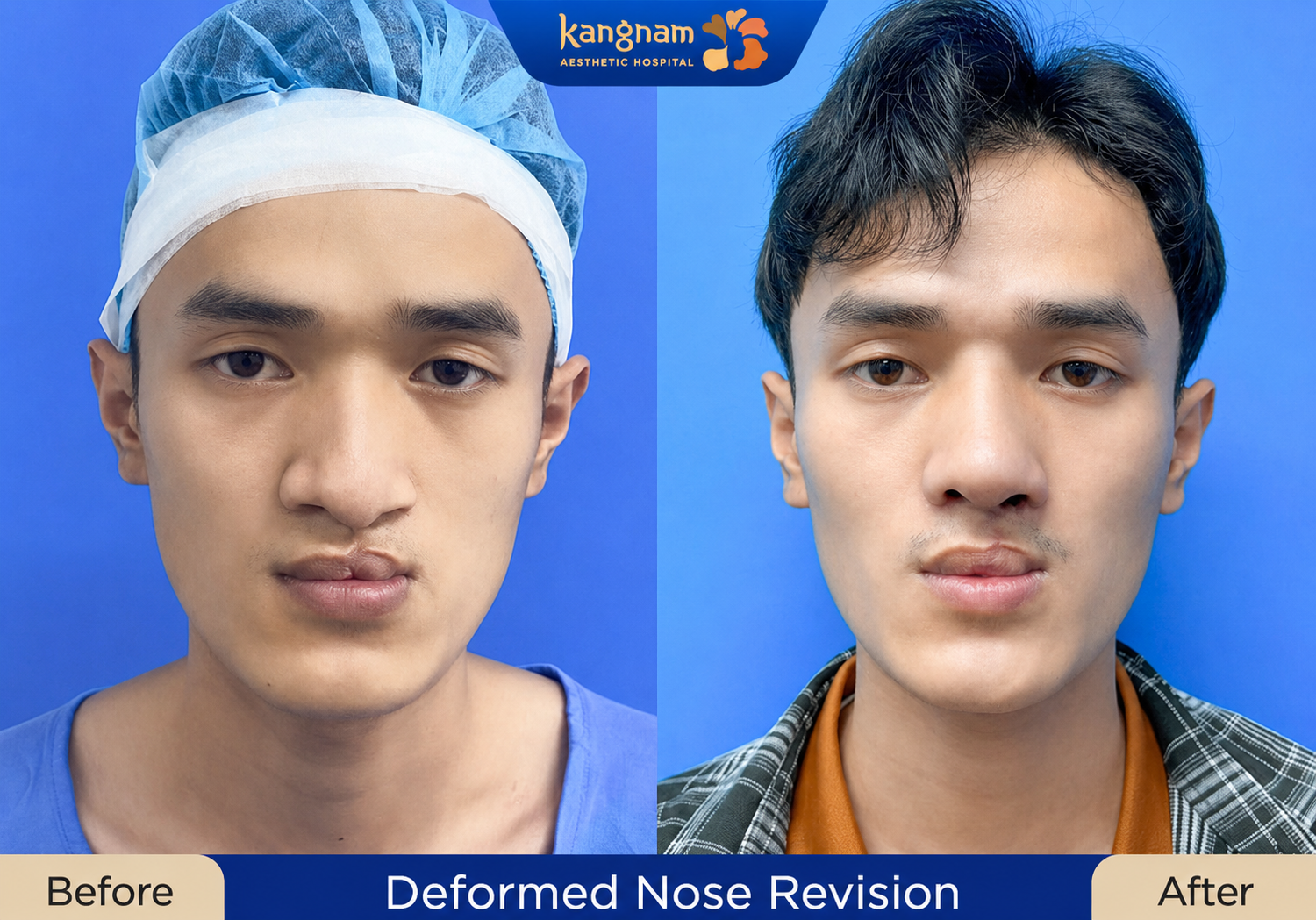 Mr. Hai, 32 years old, an overseas Vietnamese patient from Australia.
