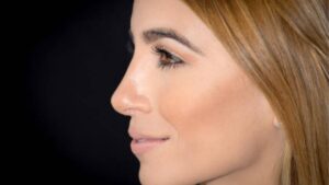 S-Line Rhinoplasty: A Naturally Curved, Elegant Nose