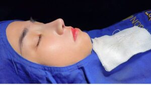 What Is Sedation (Pre-Anaesthesia) During Rhinoplasty?