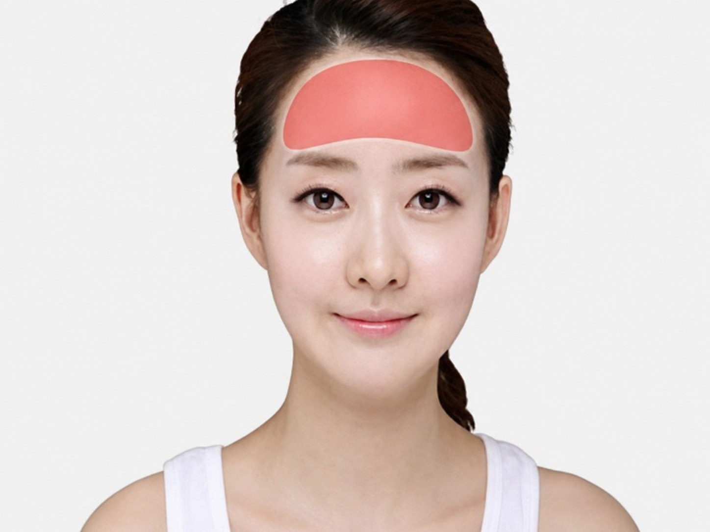Forehead filling surgery using a silicone implant
