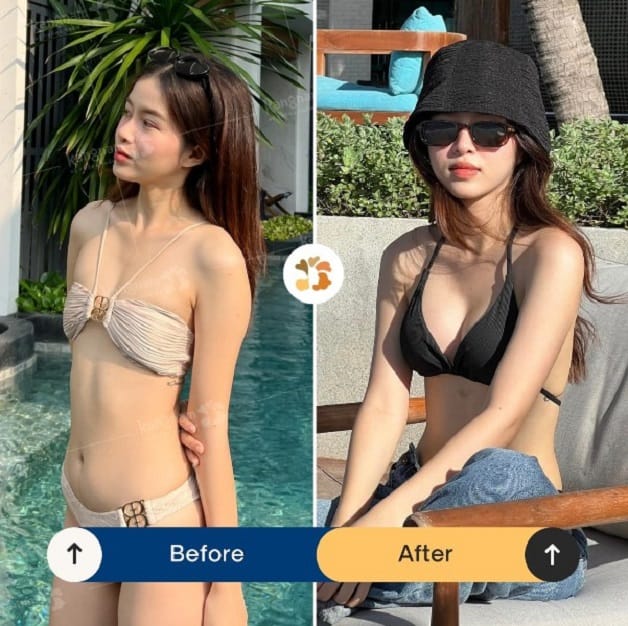 Emily Kieu Trinh looking captivating in a bikini after breast augmentation