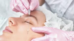 Thread Lift Side Effects to Watch Out For