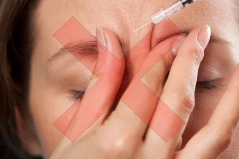 Những người mới phẫu thuật không nên tiêm botox