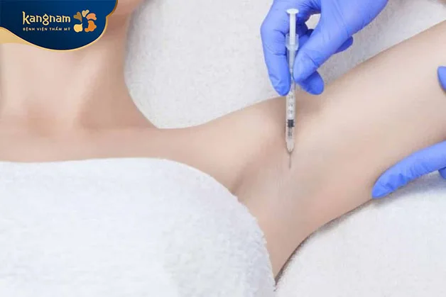 Tiêm Botox trị mùi hôi nách đảm bảo độ an toàn cao.