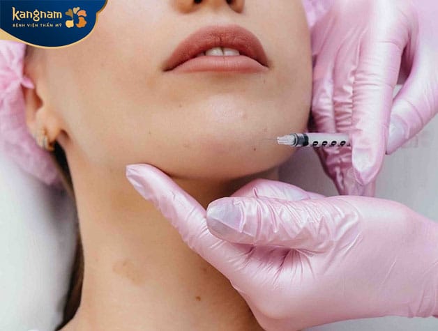 Đây là phương pháp tạo dáng cằm cân đối, thanh thoát 
