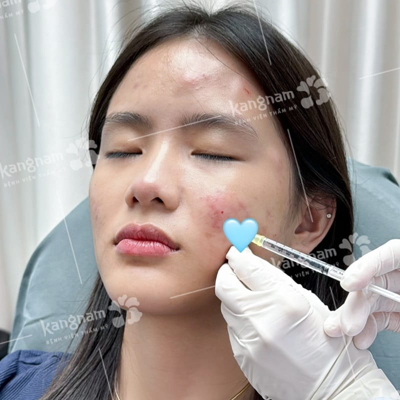Is Filler Harmful in the Long Run?