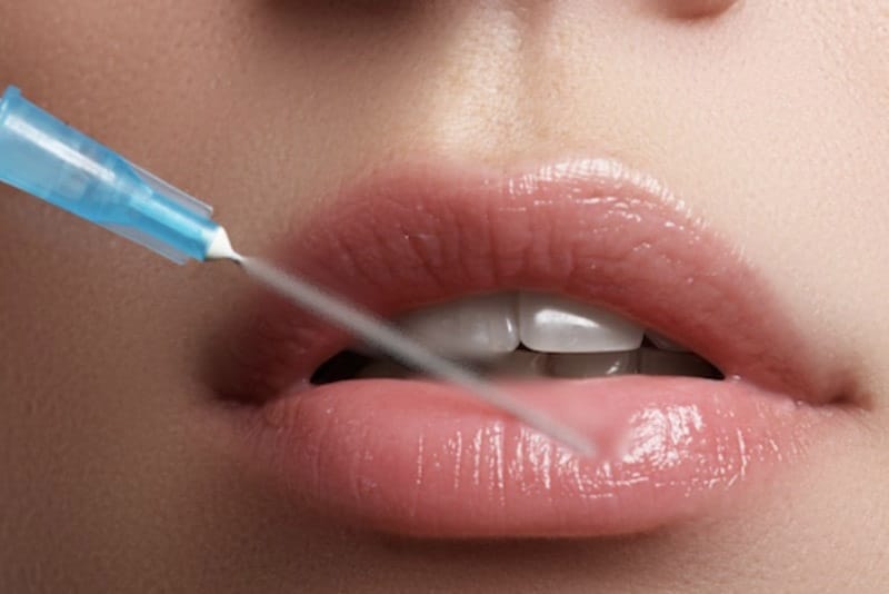 The cost of a 1cc filler injection varies considerably between products and treatment providers.