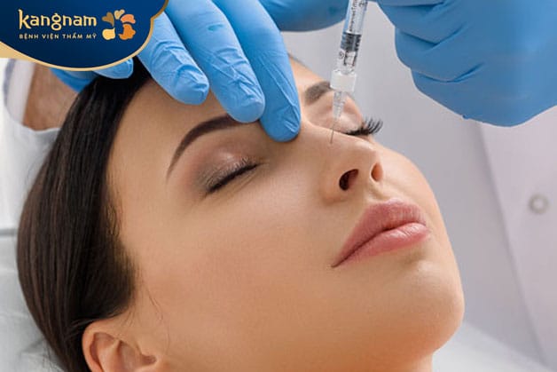Tiêm filler vùng mũi có chi phí thấp