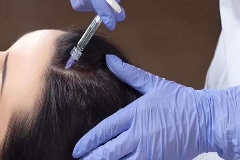The cost of hair mesotherapy also depends on the pricing and treatment policies of the selected facility.