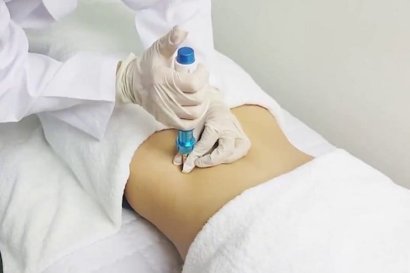 Several sessions may be required to achieve a noticeable reduction in abdominal fat.