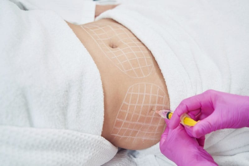 Mild swelling and tenderness may occur after abdominal fat-dissolving injections.