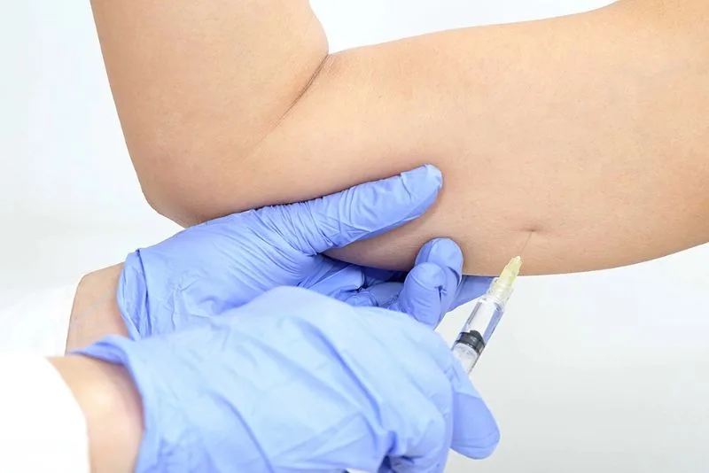 The cost of arm-slimming injections depends on the doctor's expertise.