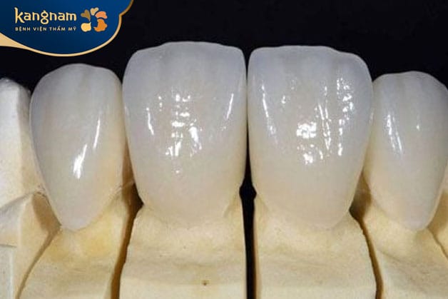 Mão sứ Emax cấu tạo từ khung sườn Lithium Disilicate