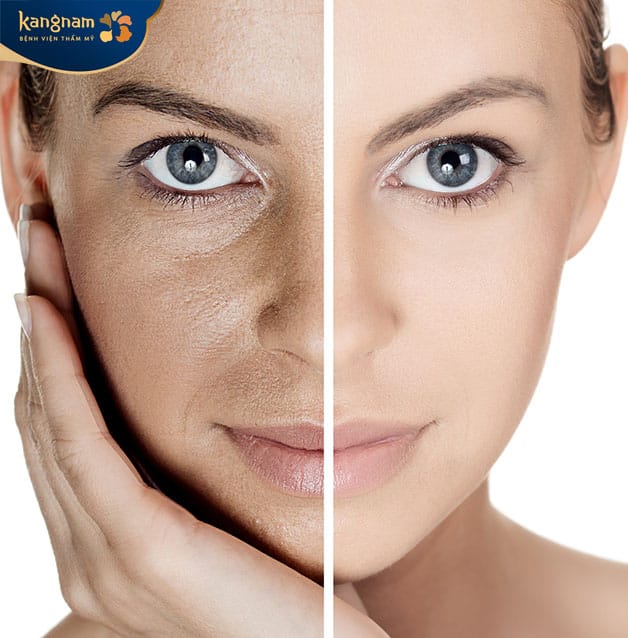 Non-Invasive Facial Rejuvenation for Younger-Looking Skin