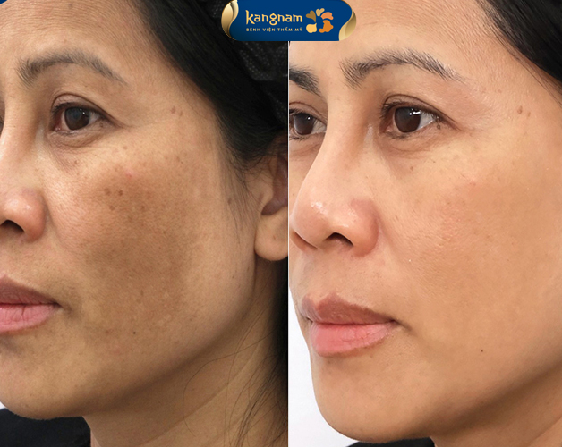 Patients with more signs of skin aging generally require higher treatment costs.