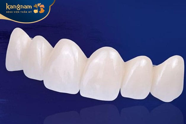 Răng sứ Emax