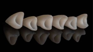 Venus Porcelain Crowns: Natural Aesthetics