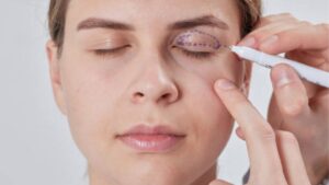 How to Reduce Swelling After Eyelid Surgery (see main article)