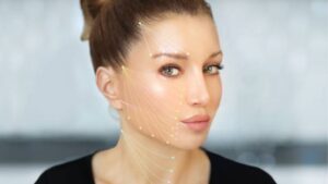 What to Avoid After a Collagen Thread Lift