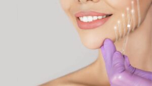 Xline Thread Lift: A Leading Anti-Aging Technique