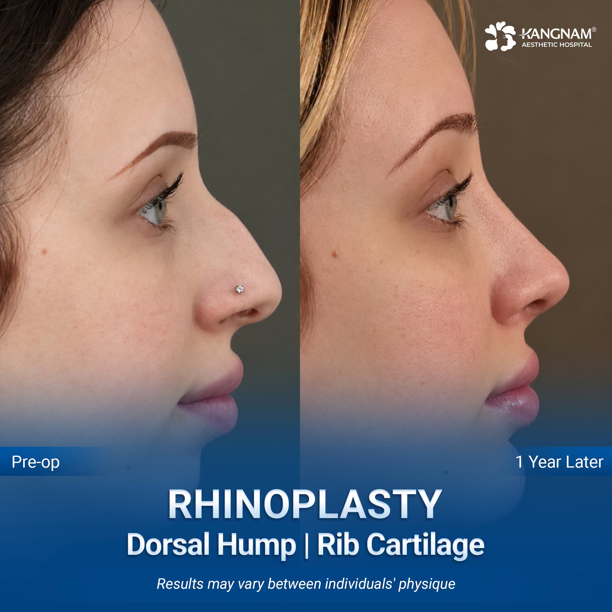 Cosmetic surgery patients in Vietnam 