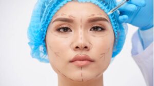 Why are so many people getting plastic surgery in Vietnam now?